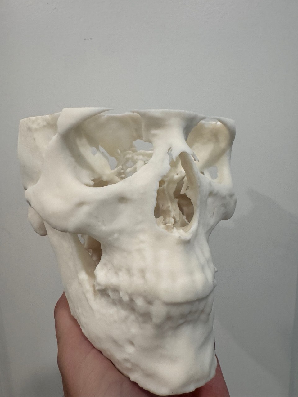 3D printed anatomical skull model